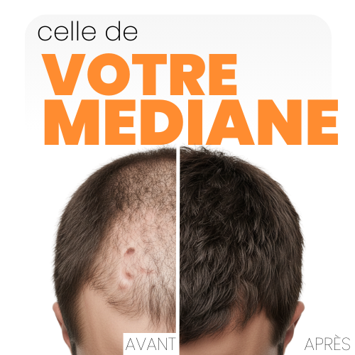 FIBRE CAPILLAIRE