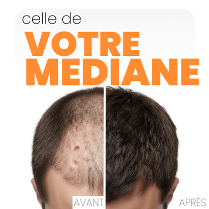 FIBRE CAPILLAIRE