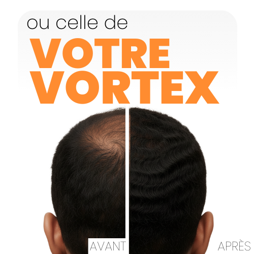 FIBRE CAPILLAIRE